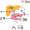 じじぃの「カオス・地球_265_すばらしい医学・膵臓・なくても生きられる臓器？」