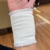 ドゲルバン病の手術
