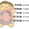 左上の隙間部位の歯（乳犬歯）が生えてきた（1歳5ヶ月）