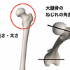 股関節の形とターンアウト