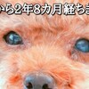 白内障と、兄弟の話。