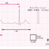 心電図　基礎と正常波形