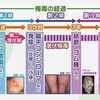 梅毒は見逃されやすい