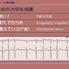 【コラム-129：心電図検定試験-2A合格から1B合格までシリーズ001：心房細動(その１-- ２級合格のためのTips)】