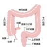 大腸がんの予防と治療：この10年の進歩と今後の展望