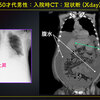 ECG−340：answer