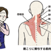 関節調整から見た肩こり