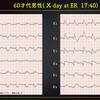 ECG-316：answer (2/2)