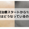 肝斑治療1か月の経過報告【敏感肌・乾燥肌・アトピー肌・アラフォー】