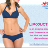 Liposuction in Delhi –Importance of performing it safely! 