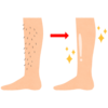 脱毛のフリーイラスト素材