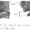  高分解能MRIによる輪状甲状関節の観測 