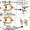 逆まつげの治療について図説するよ