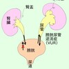 他の症状のない発熱