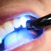 Chuyên gia chia sẻ cách làm hết nhức răng