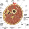 伏臥位が不可能な患者の大腿後面へのアプローチ（膝痛）