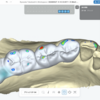 CADでブリッジを作ろう！②ブリッジを作れるサブスクCADソフトの使用感〜Dentbird＆ClinicCAD