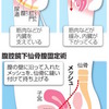 骨盤臓器脱