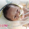 🌷退院日🐣【生後６日目】腹壁破裂ベビー🍼