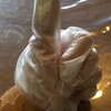 親指負傷おばはん
