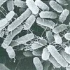 要冷蔵食品の恐怖！ボツリヌス食中毒から身を守る7つの警告サイン【医療機関も警告】