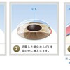 ICLやったった：術前検査（1クリニック目）編