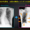 【ECG-320】：answer