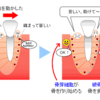 歯がミシミシいう…