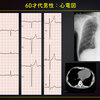 ECG-324：answer (1/2)