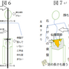 三叉神経痛の原因