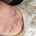 Down syndrome log