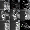 彗星67P/チュリュモフ・ゲラシメンコのコンスー地域における岩石移動