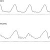 高速イメージング，音響スペクトル，逆フィルタリングを用いたモンゴルの「喉歌」の音源特性の研究