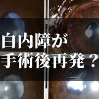 犬の白内障手術の費用はこれだけかかりました コジロウ備忘録 Zakionote ザキオノート