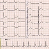 ECG-232：70才代女性。転倒打撲で来院されました。