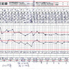 血圧記録1９日間