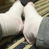 「薬疹」でエラい目にあっている【グロ注意】