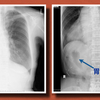 ECG-122：answer