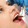 Dịch vụ nhổ răng giá rẻ tại hcm