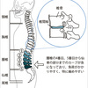 関節調整から見た腰痛