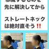 ストレートネックと猫背