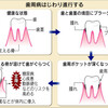 歯周病