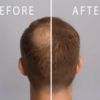 薄毛隠しを自然に仕上げる！髪の毛をフサフサに見せてくれるヘアカバースプレー