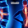 What Is The Treatment for Spinal Fracture?