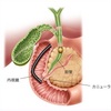 ERCPって痛いの？