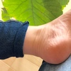 かかとのカサカサが改善！お湯のみで洗ったら全身潤った