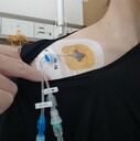 潰瘍性大腸炎(UC)と毎日の食事