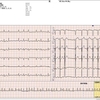 ECG-206：90才代男性。動悸と息切れで搬入されました。