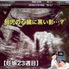 【妊娠23週目】胎児の心臓に小さな黒い影があると言われた日