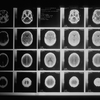 3人に1人は苦手意識を持っている脳画像を今から学びませんか？